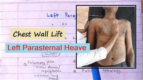 lv heave|right ventricular heave meaning.